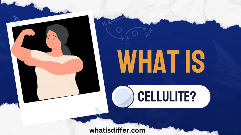 What is The Difference Cellulitis 