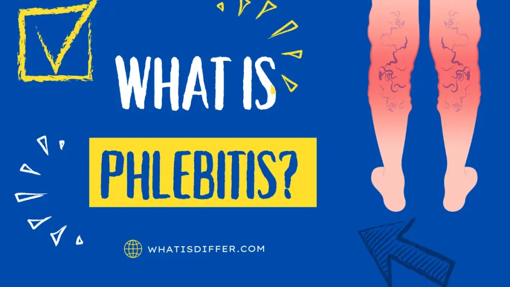 What is The Phlebitis